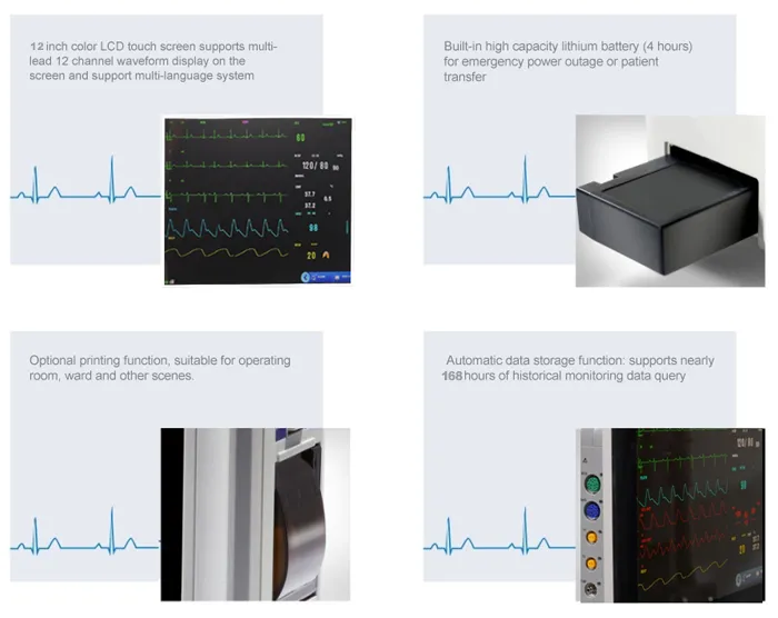 Patient Monitor View 3