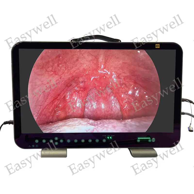 Endoscopy Camera Full Set