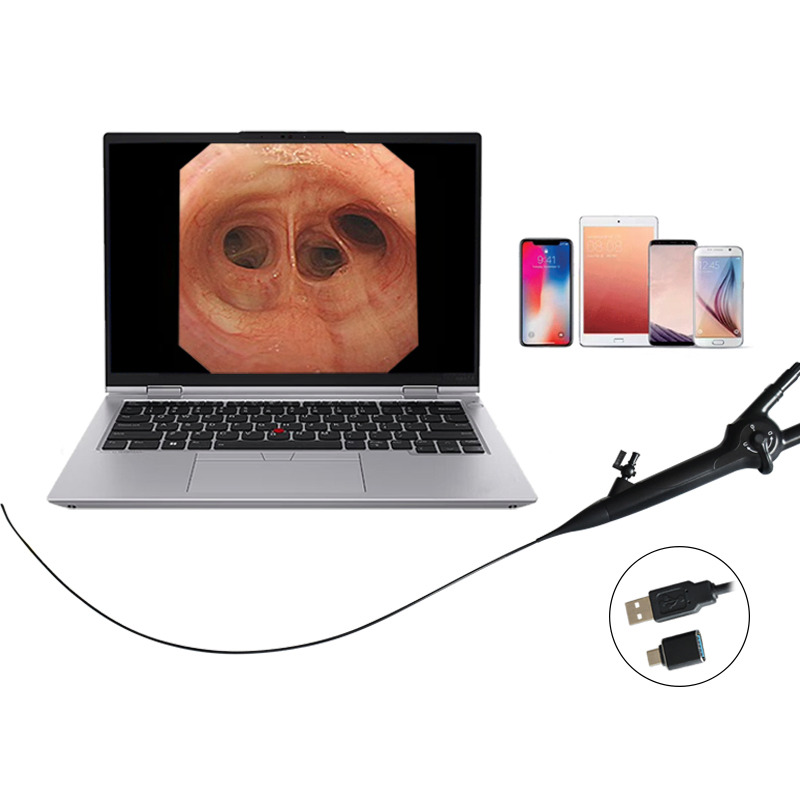 Geiwre High Quality Medical Flexible Endoscopy Camera System