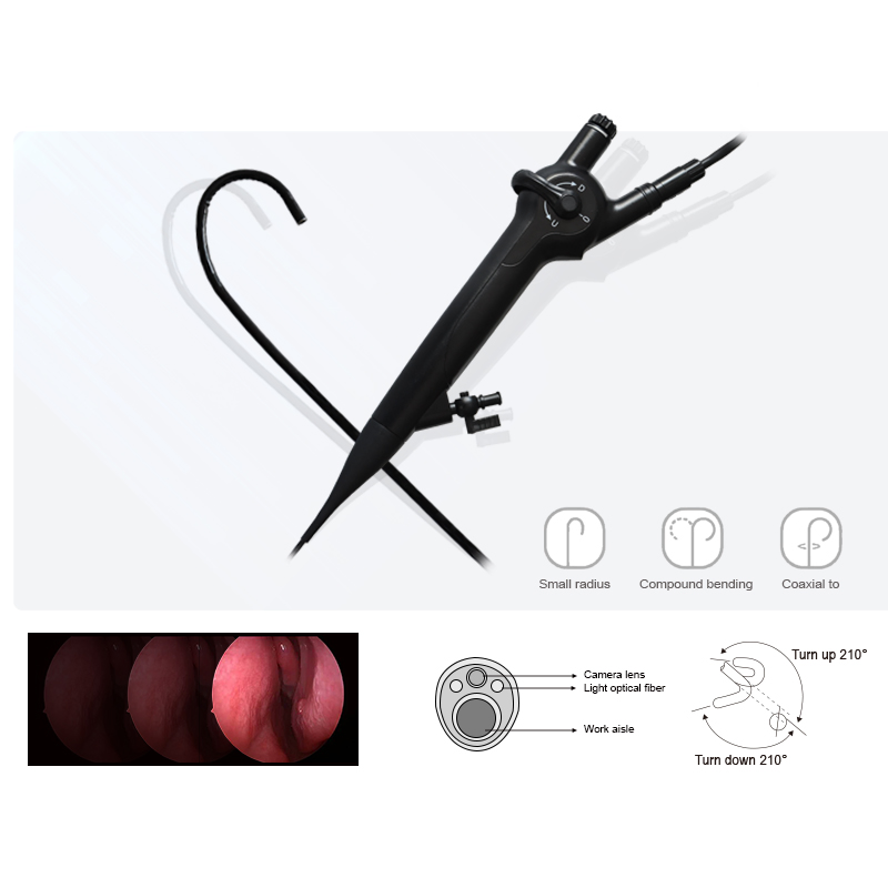 Geiwre High Quality Medical Flexible Endoscopy Camera System