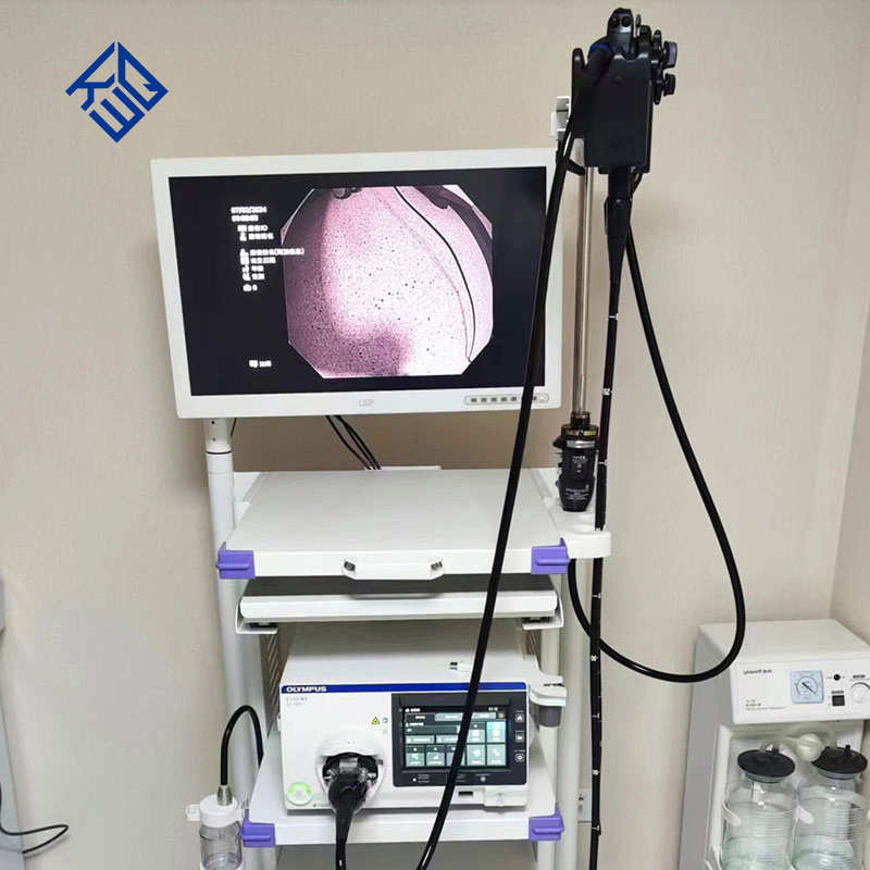 High Definition Electronic Gastrointestinal Video Endoscopy System