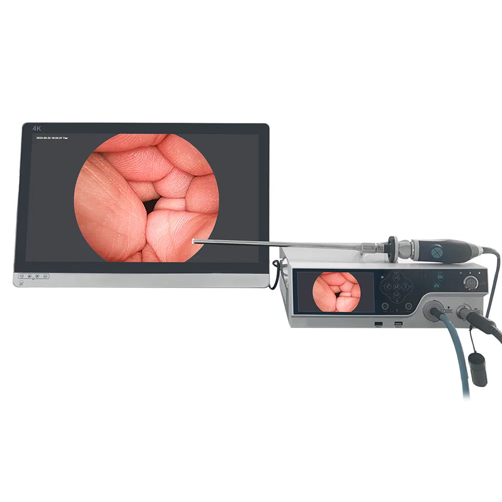 ICEN Full Hd Endoscopy Camera Endoscope Imaging System