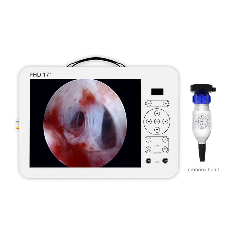 Portable Laparoscopy Endoscope Medical Equipment Endoscopy Camera Image System