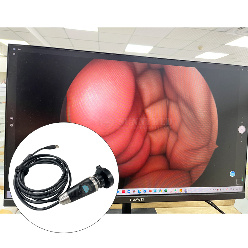Sy-P031HD3 Rigid Endoscope Instrument Medical Mini Endoscope Camera for Hot Sale