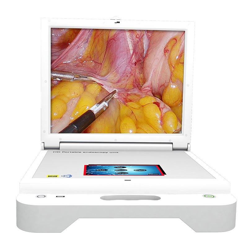 Medical Otolaryngology Portable Endoscopy Machine Camera Unit System