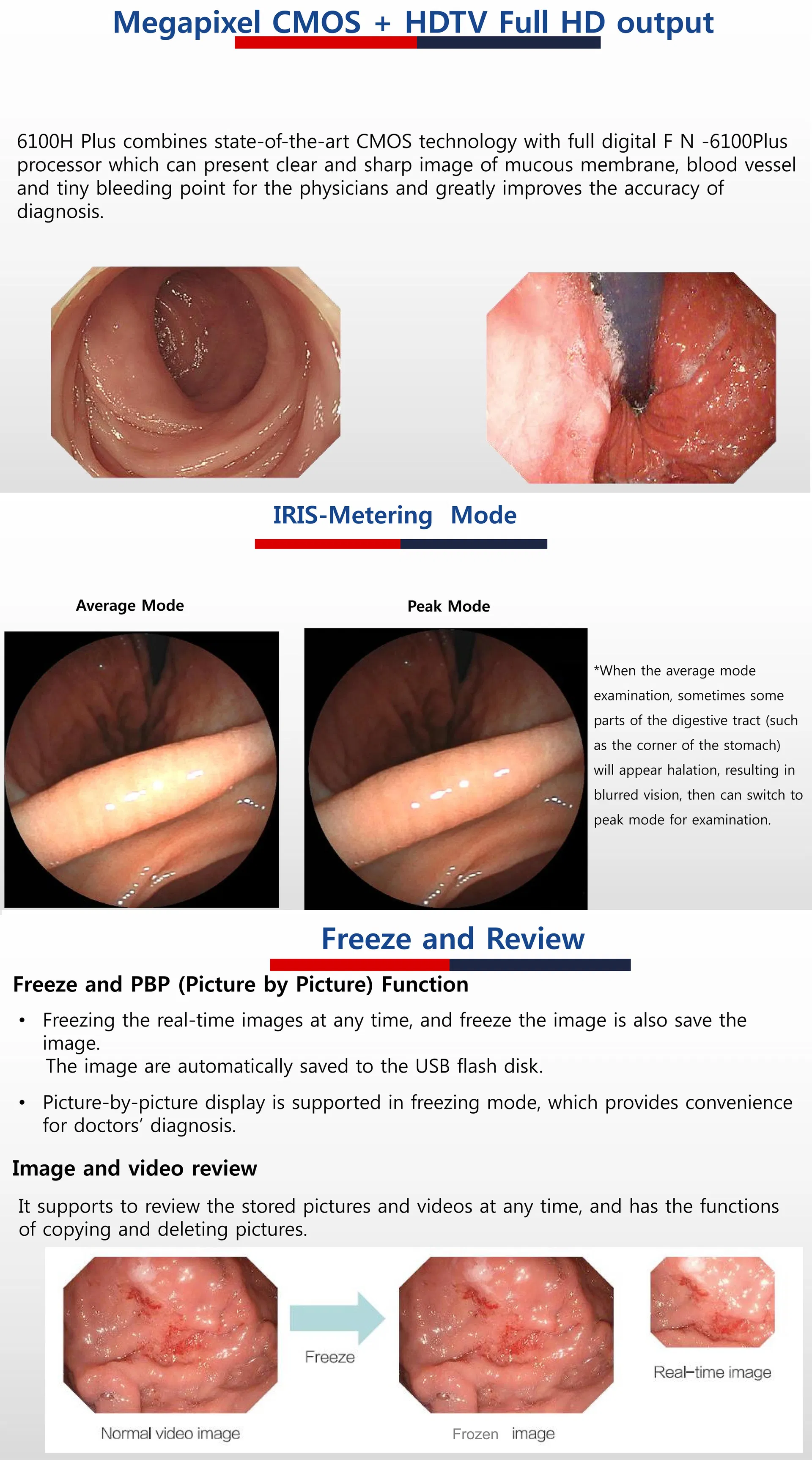 Endoscopy System Detail 6