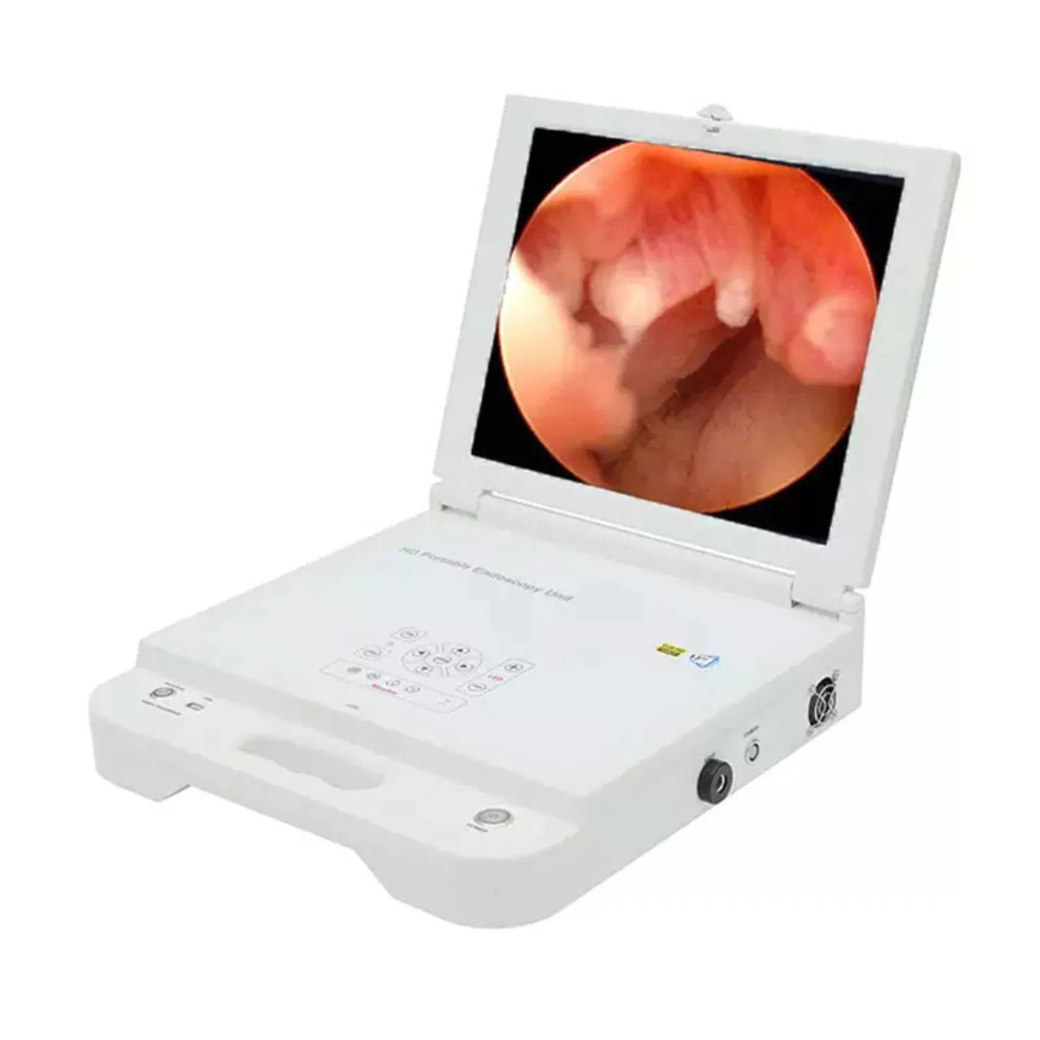 Medical Portable Endoscopic Camera System for Endoscopy