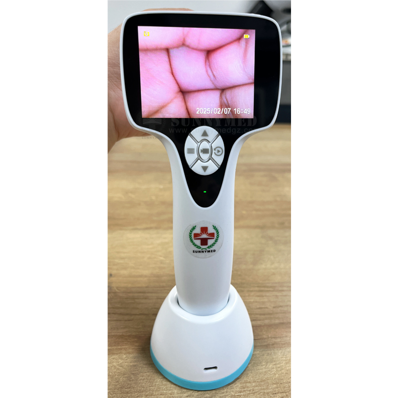 Sy-G046-2 Veterinary Portable 3.5 Inch Digital Ear Endoscopy Camera Otoscope