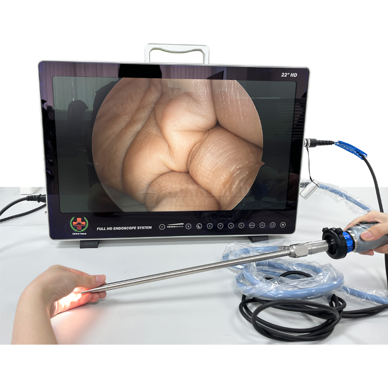 Sy-PS050 Portable Integrated Endoscopy HD Camera System Unit Ent Multi Function Handheld Full HD Camera and 4 in One Endoscope