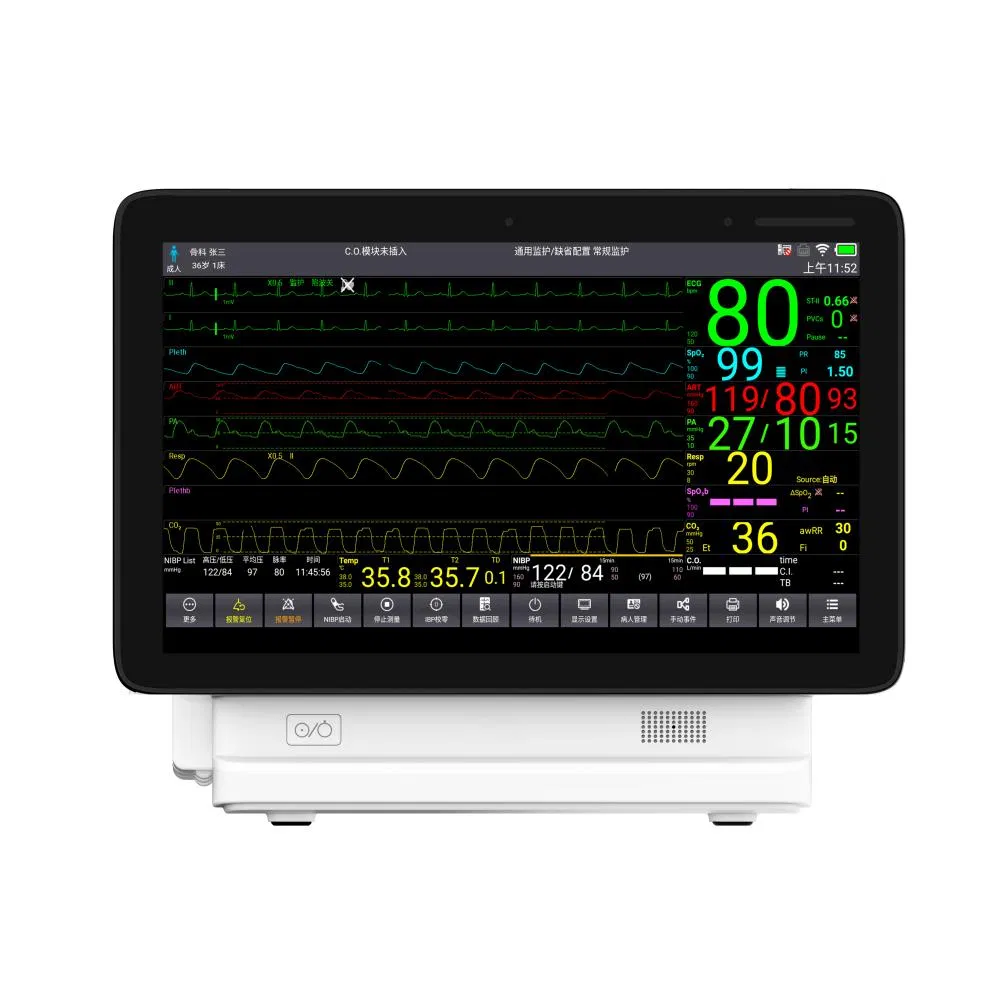 Advanced Mobile ICU Patient Monitoring System for Healthcare Professionals