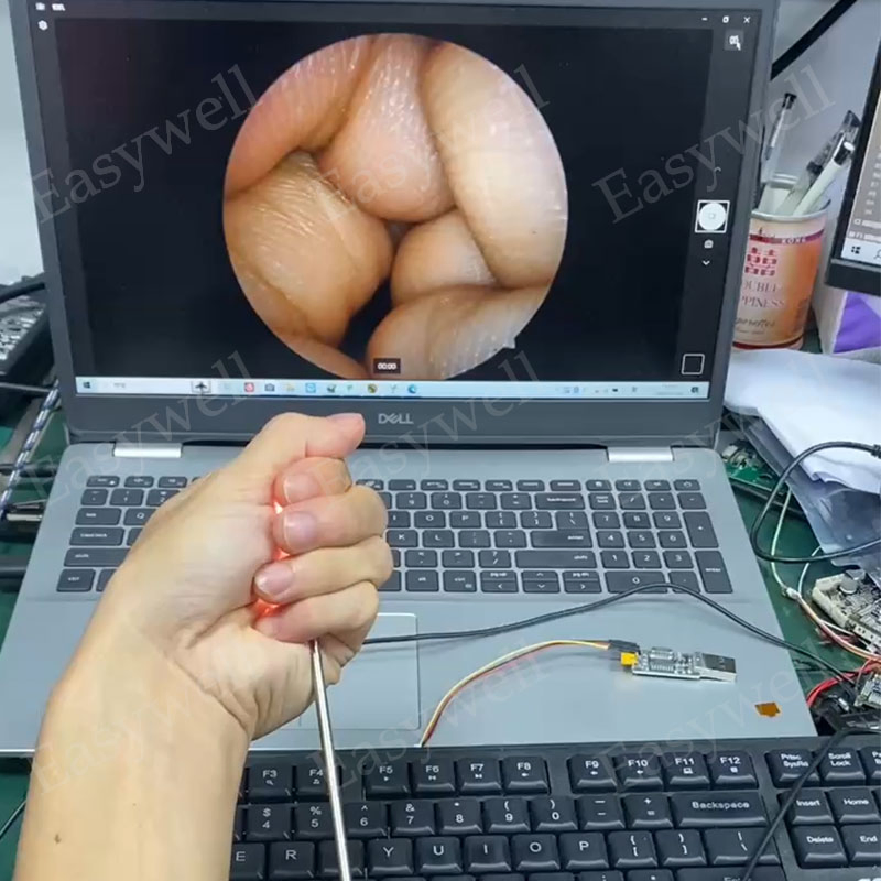 3.0 USB Endoscopic Camera System E09u Without Optical Coupler