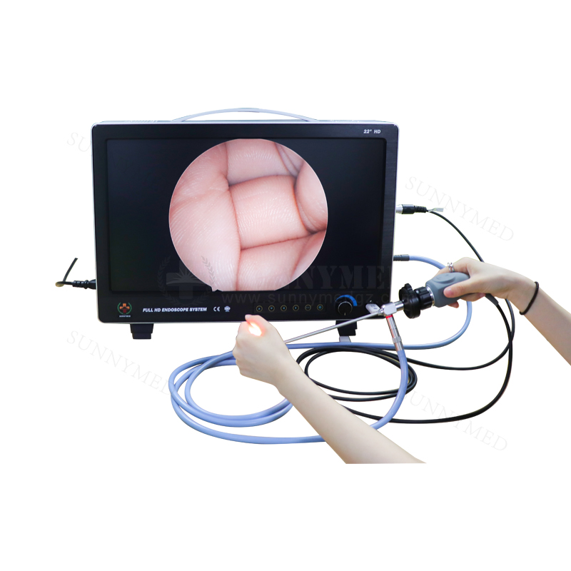 Portable Endoscopy Camera Telepack Endoscope Camera System for Ent/Laparoscopy/Hysteroscopy/Urology