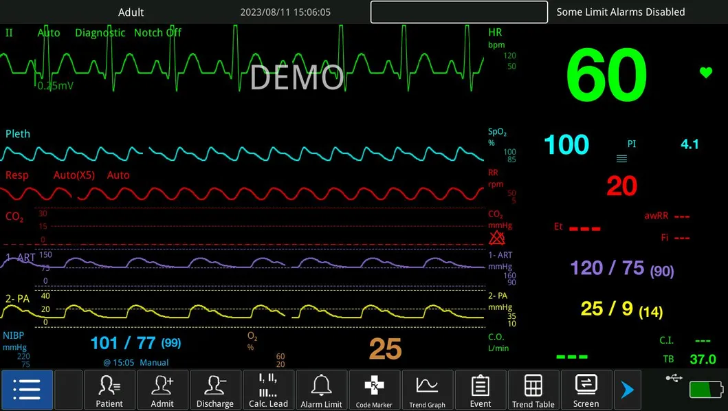 ICU Monitor Setup
