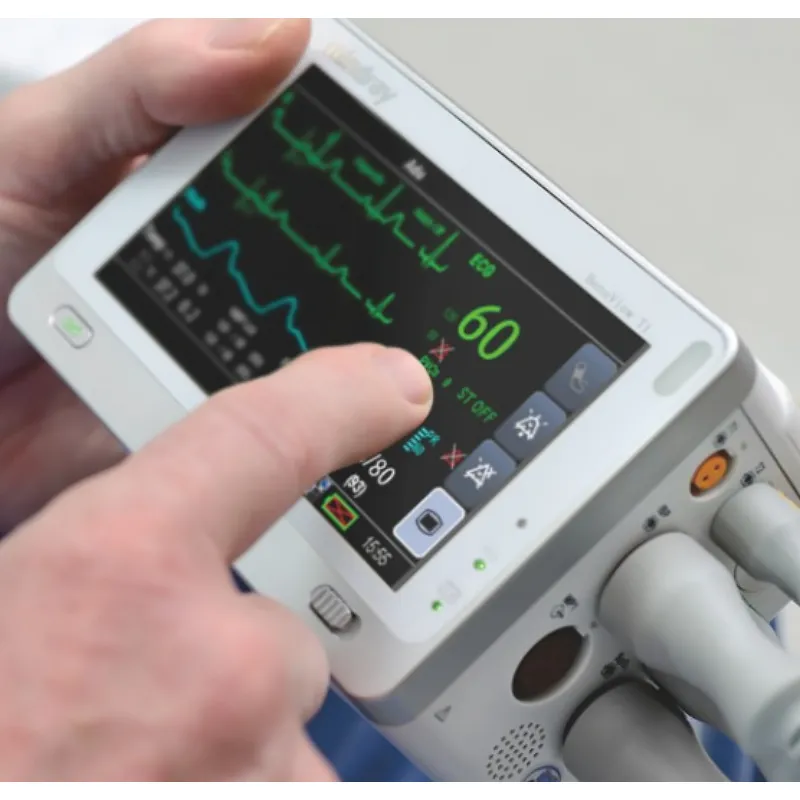 Patient Monitor View 5