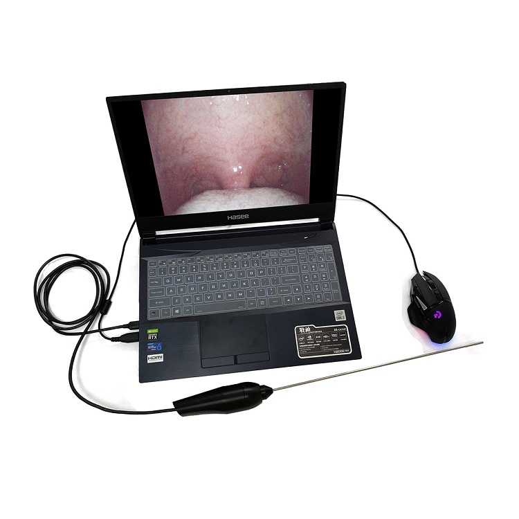 Portable Video Fiber Optic Pediatric Sigmoidoscope Endoscopy Equipment