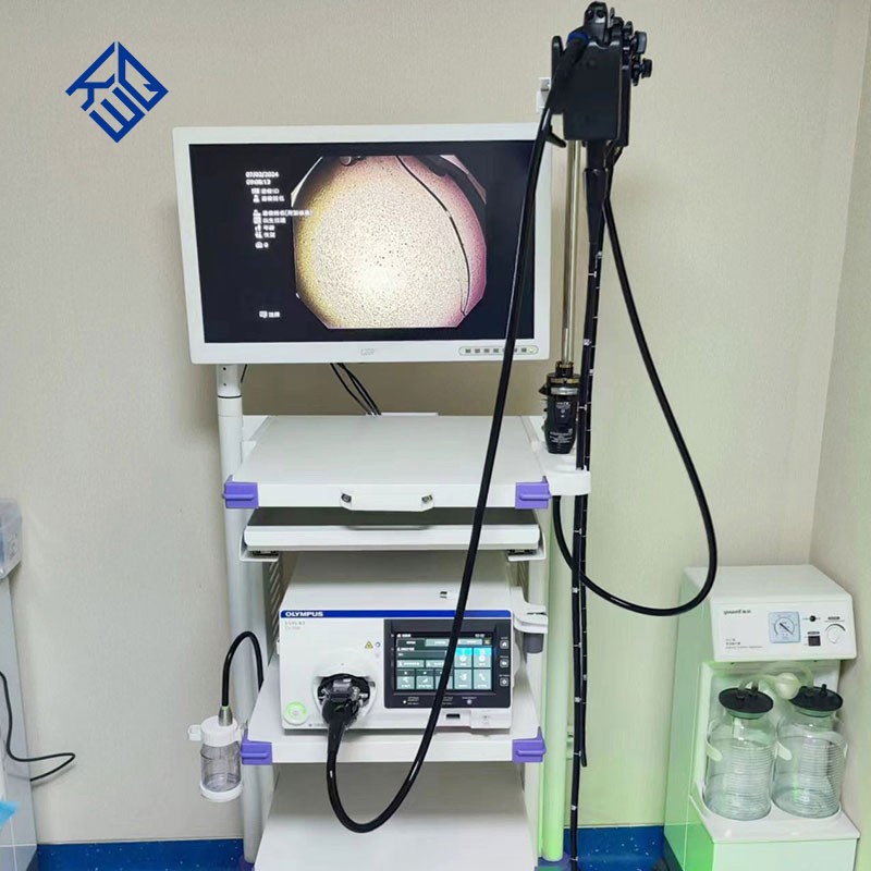 High Definition Electronic Gastrointestinal Video Endoscopy System
