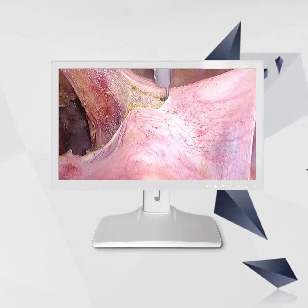 27 Inch 4K Medical Display