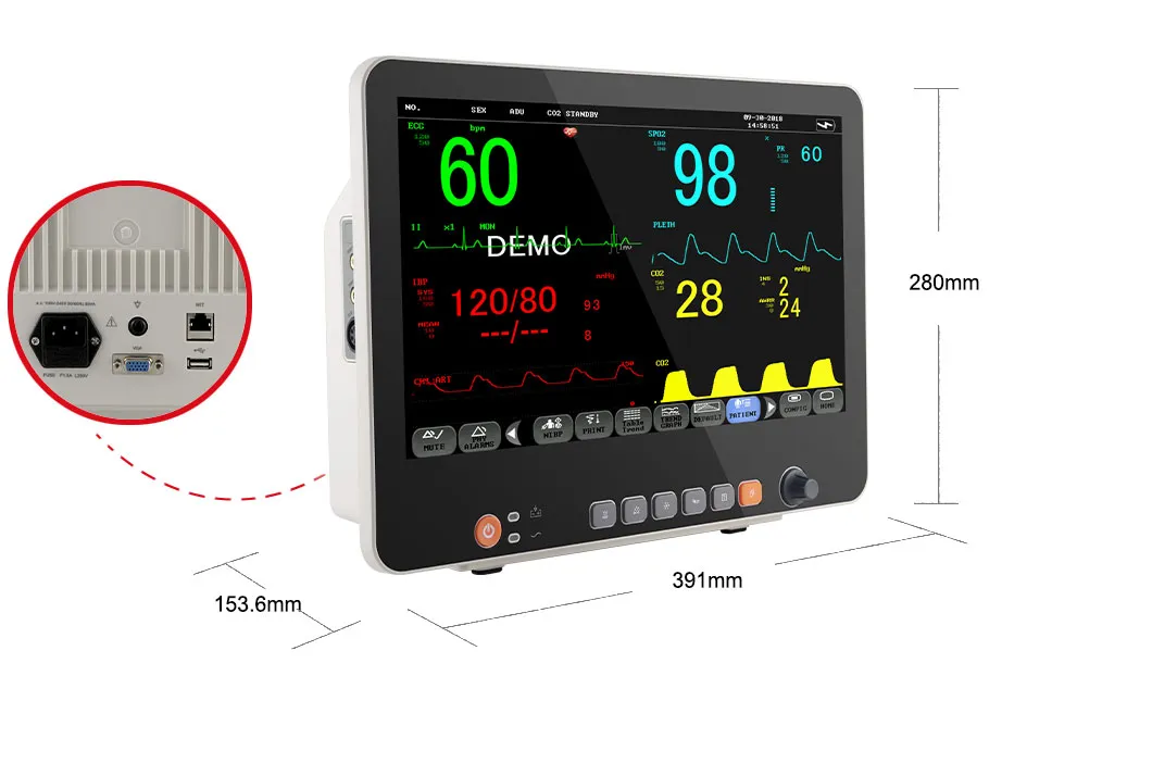 Patient Monitor View 6