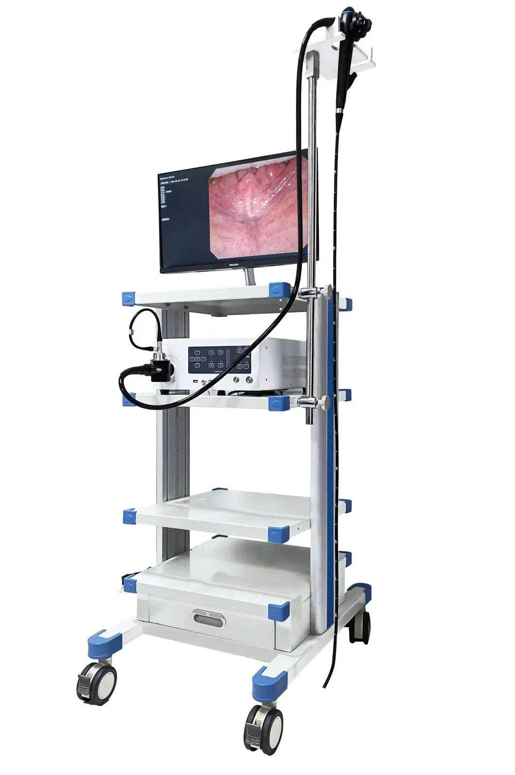 Professional Portable Pet Endoscopy System with High-Quality Camera