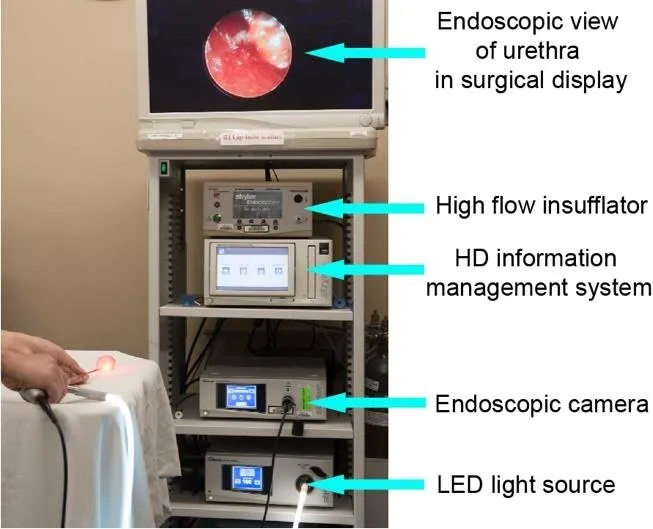 Full HD Endoscopy Camera
