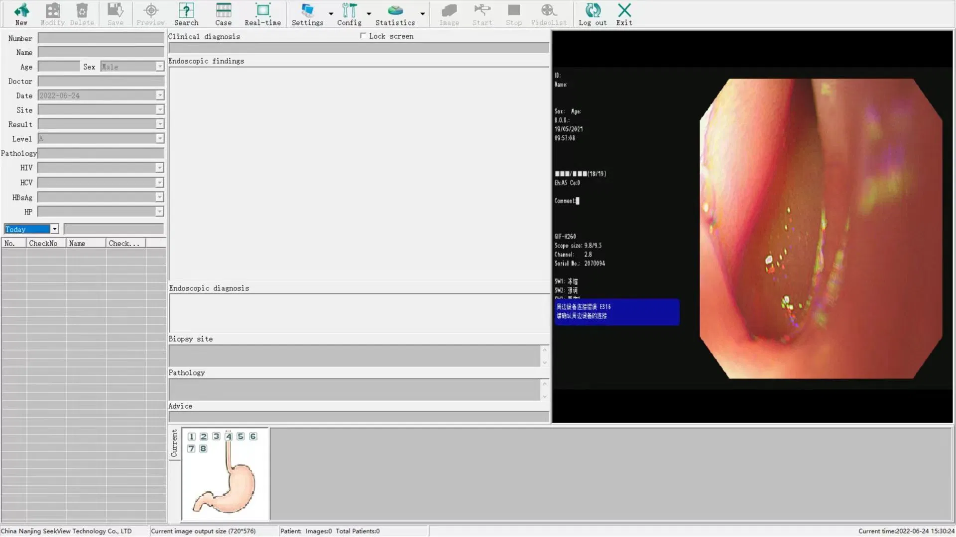 Endoscopy System Detail 6