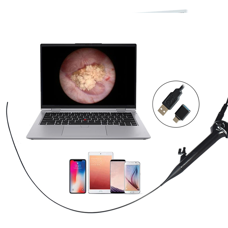 Single Use Digital Bronchoscopy Flexible for Hospital Operations Surgery