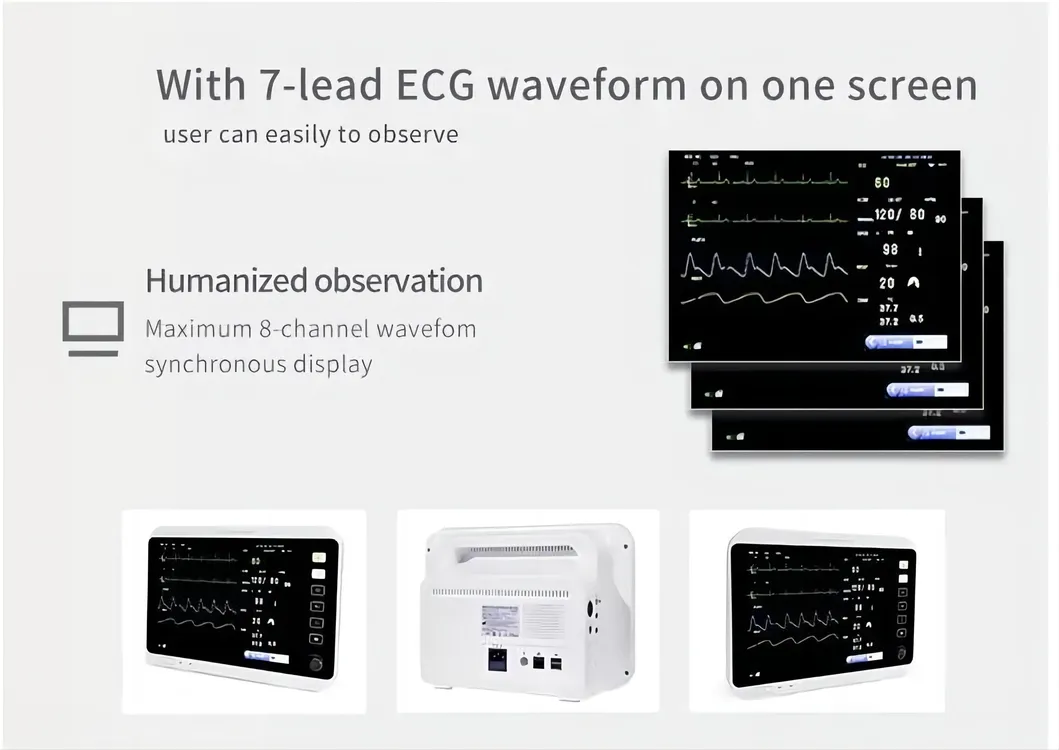 Patient Monitor View 4