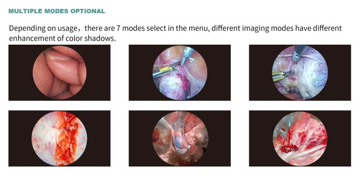 Cheap 1080P HD Medical Ent Laparoscopy Camera Endoscope Machine Video Endoscopy System