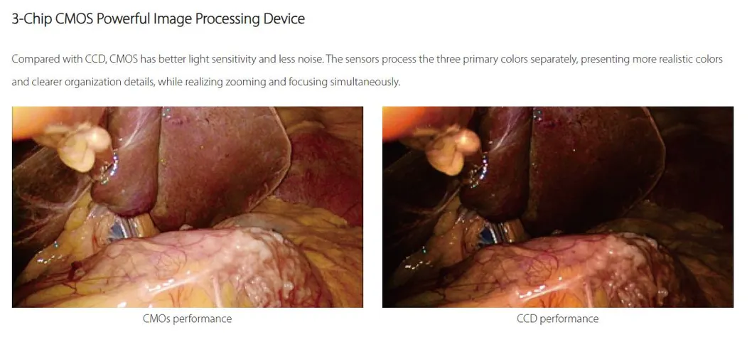Endoscopy System 3