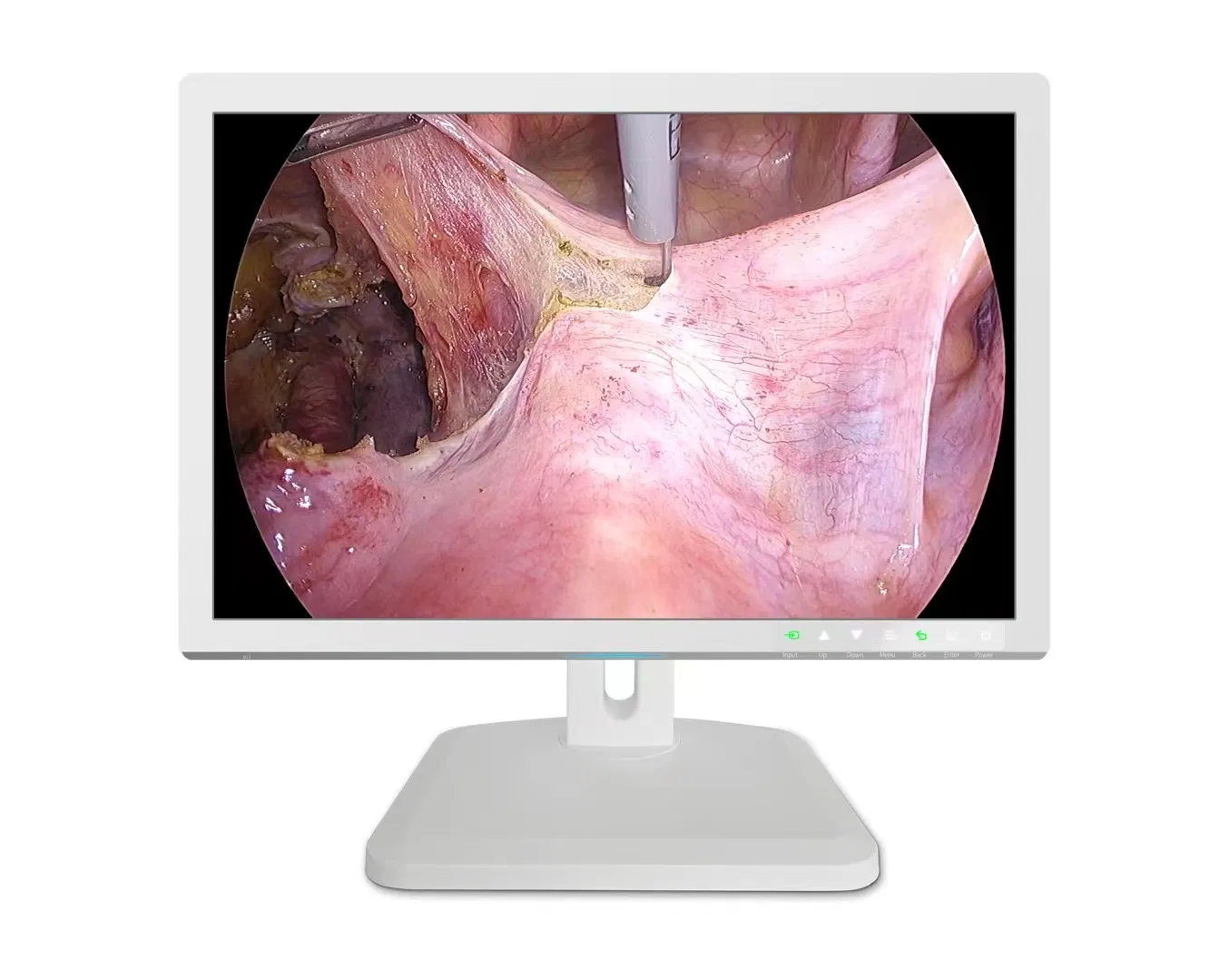 27 Inch 4K Medical Display