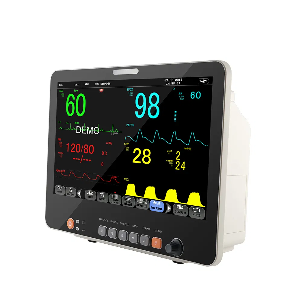Patient Monitor View 3