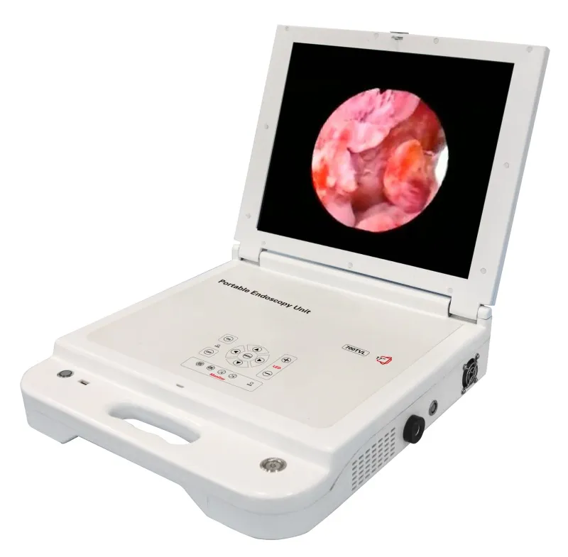 Portable HD Ent Endoscopy System