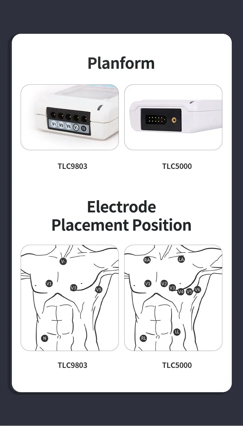 EKG Waveform Analysis