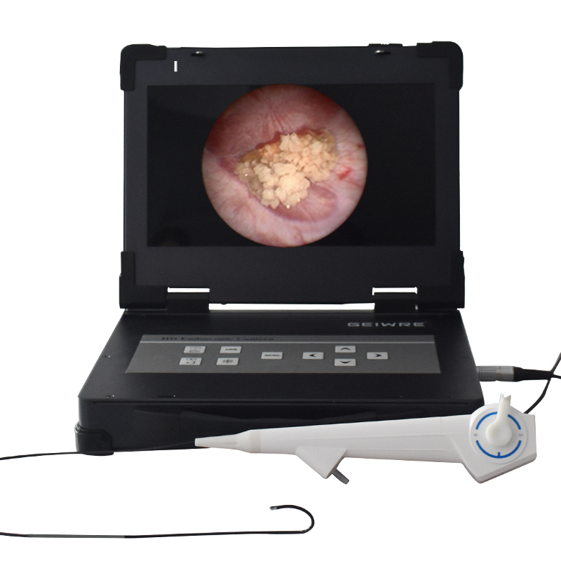 High Definition Integrated Endoscopy Camera Flexible Rigid Medical Imaging Equipment