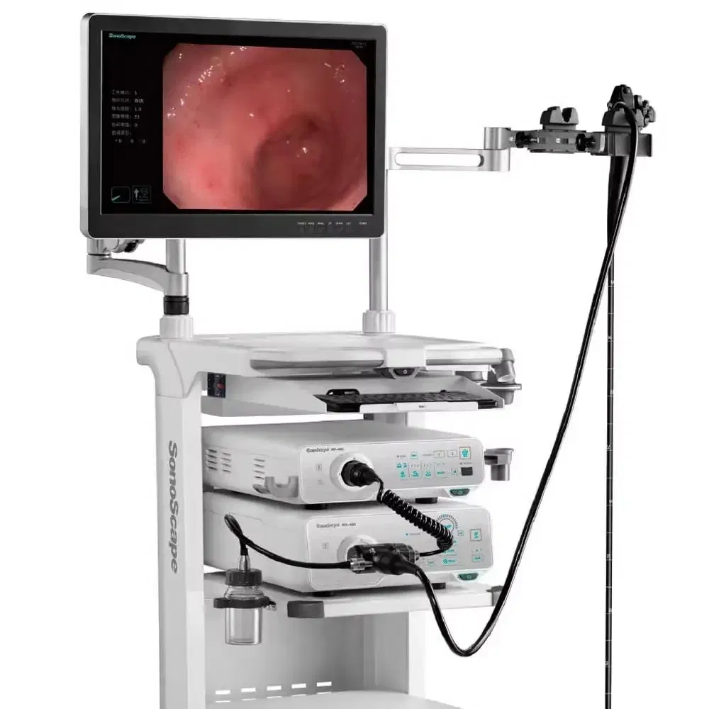 Sonoscape HD350 Professional Human Medical Video Endoscopy System Gastroenteroscopy