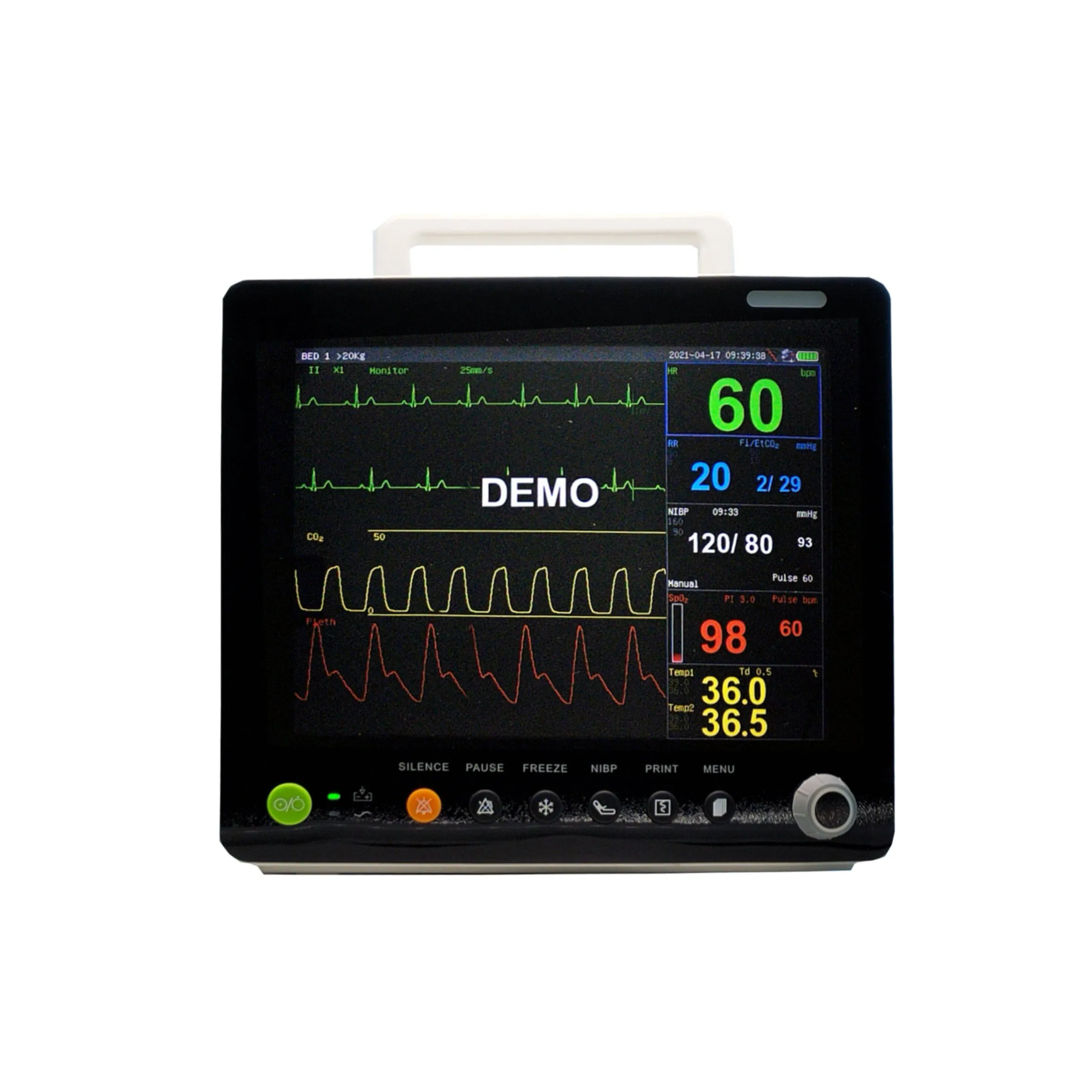 Multi Parameter Veterinary Monitoring System for Animal Physiological