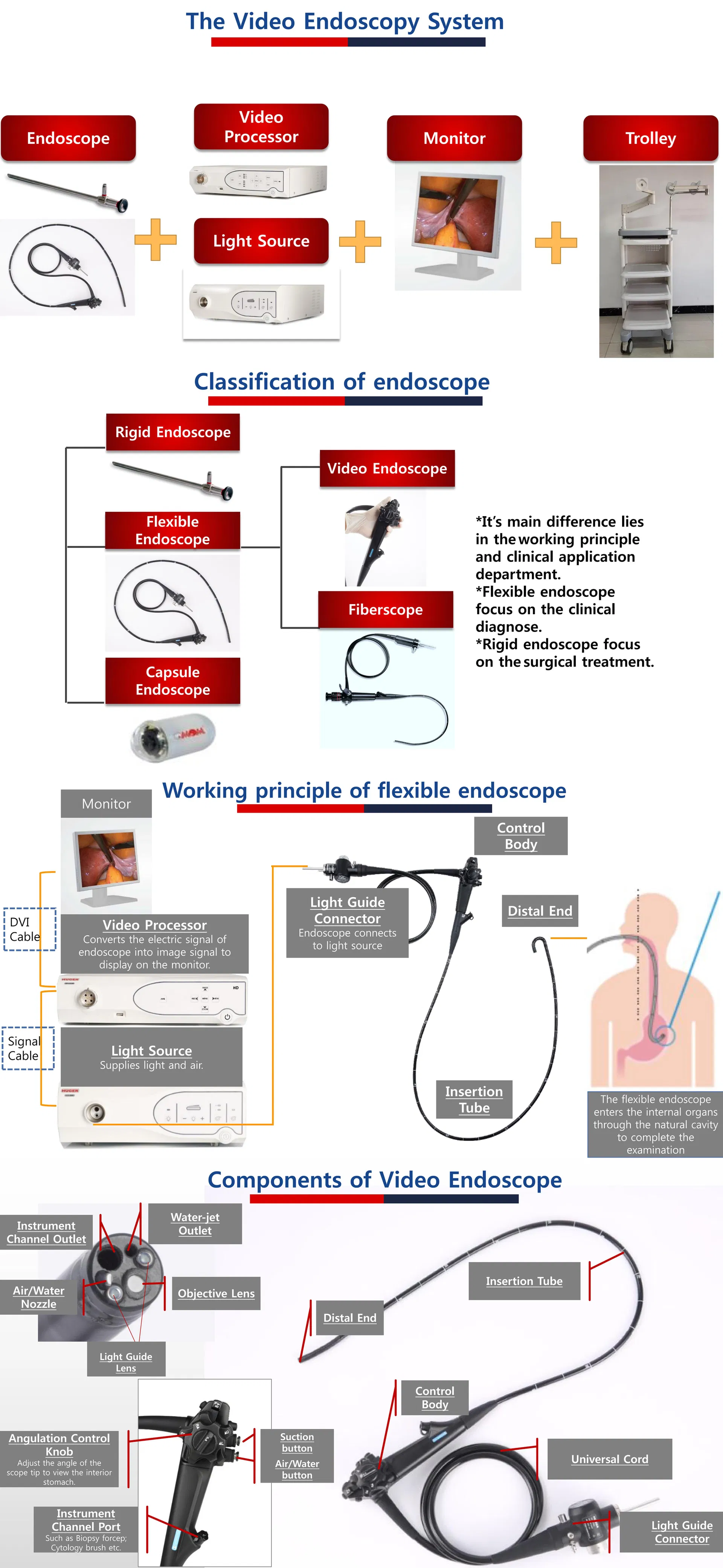 Endoscopy System Detail 1