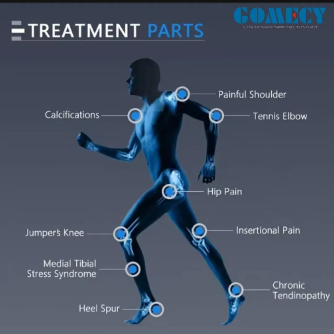 Focus Shockwave Therapy Shockwave Pain Frozen Shoulder Achilles Tendonitis Therapy Device