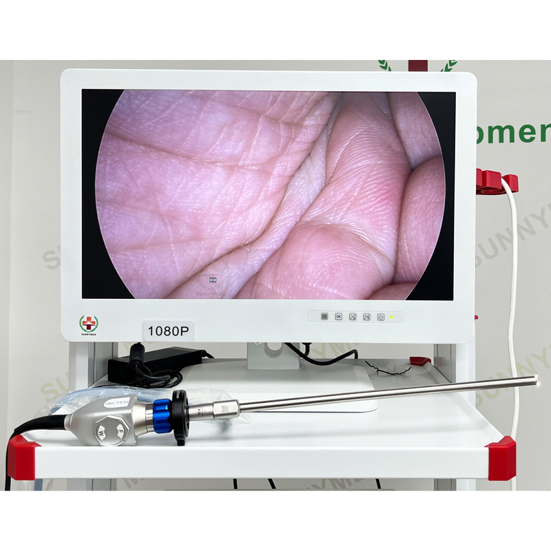 Sy-PS049 HD Rigid Bronchoscopy Laparoscopy Endoscopy Camera Equipment Set Tower