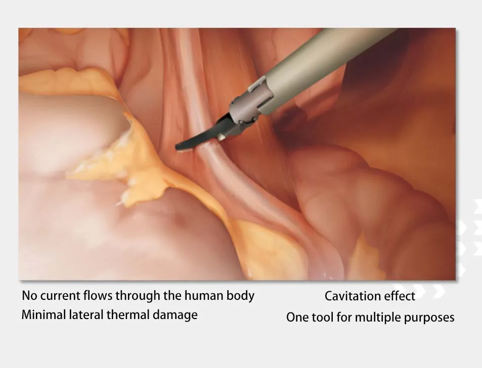 Ultrasonic Scalpel System 8