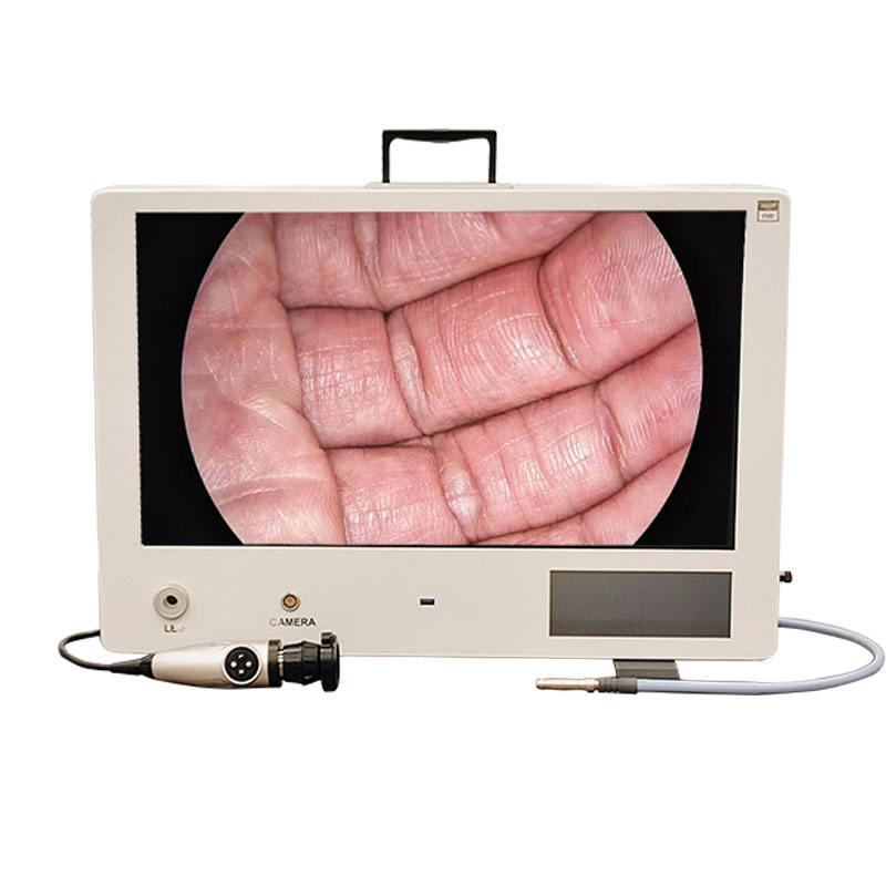 High-Definition Ureteroscope Camera System for Flexible Endoscopy