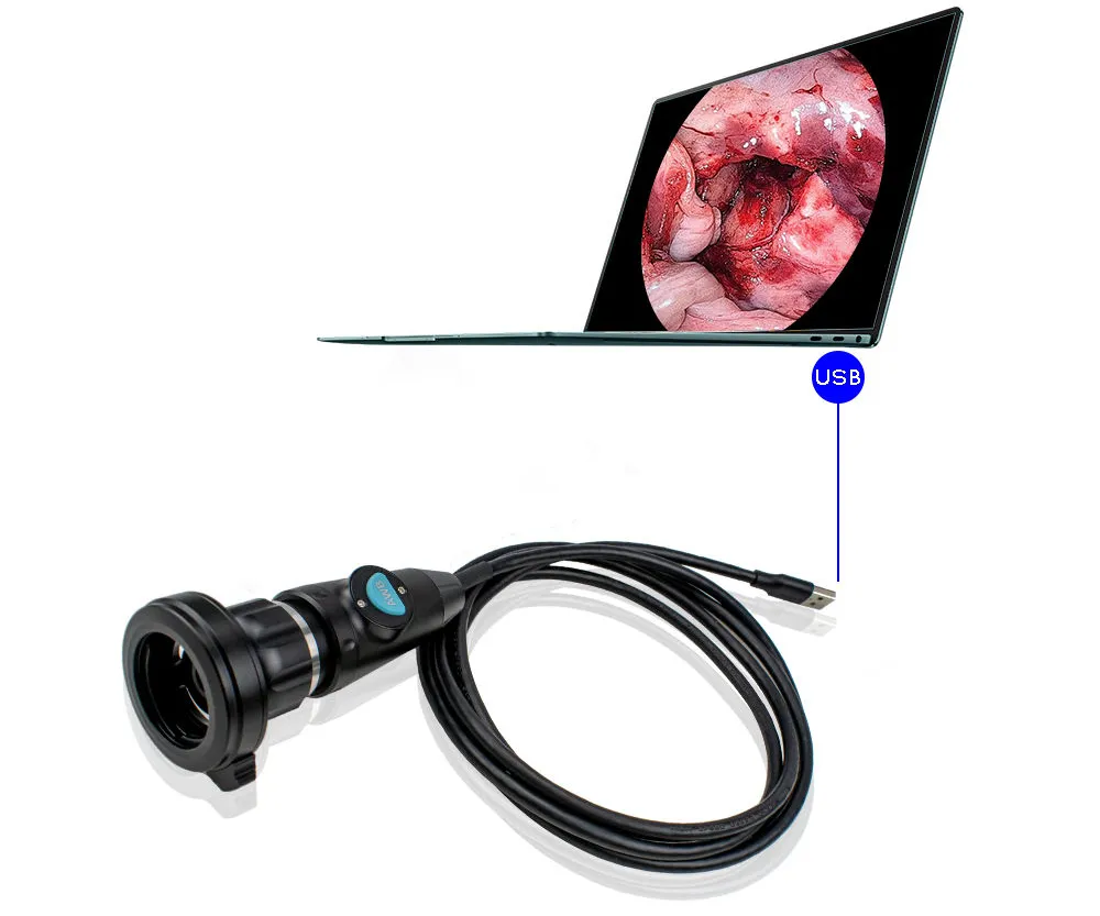 USB Endoscope Camera Detail 1