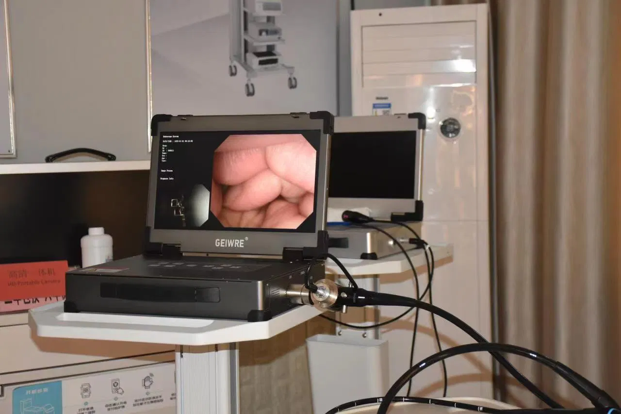 Geiwre Flexible Endoscopy Camera System for Medical