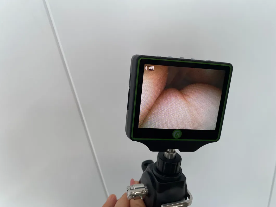 Bronchoscope Detail 3