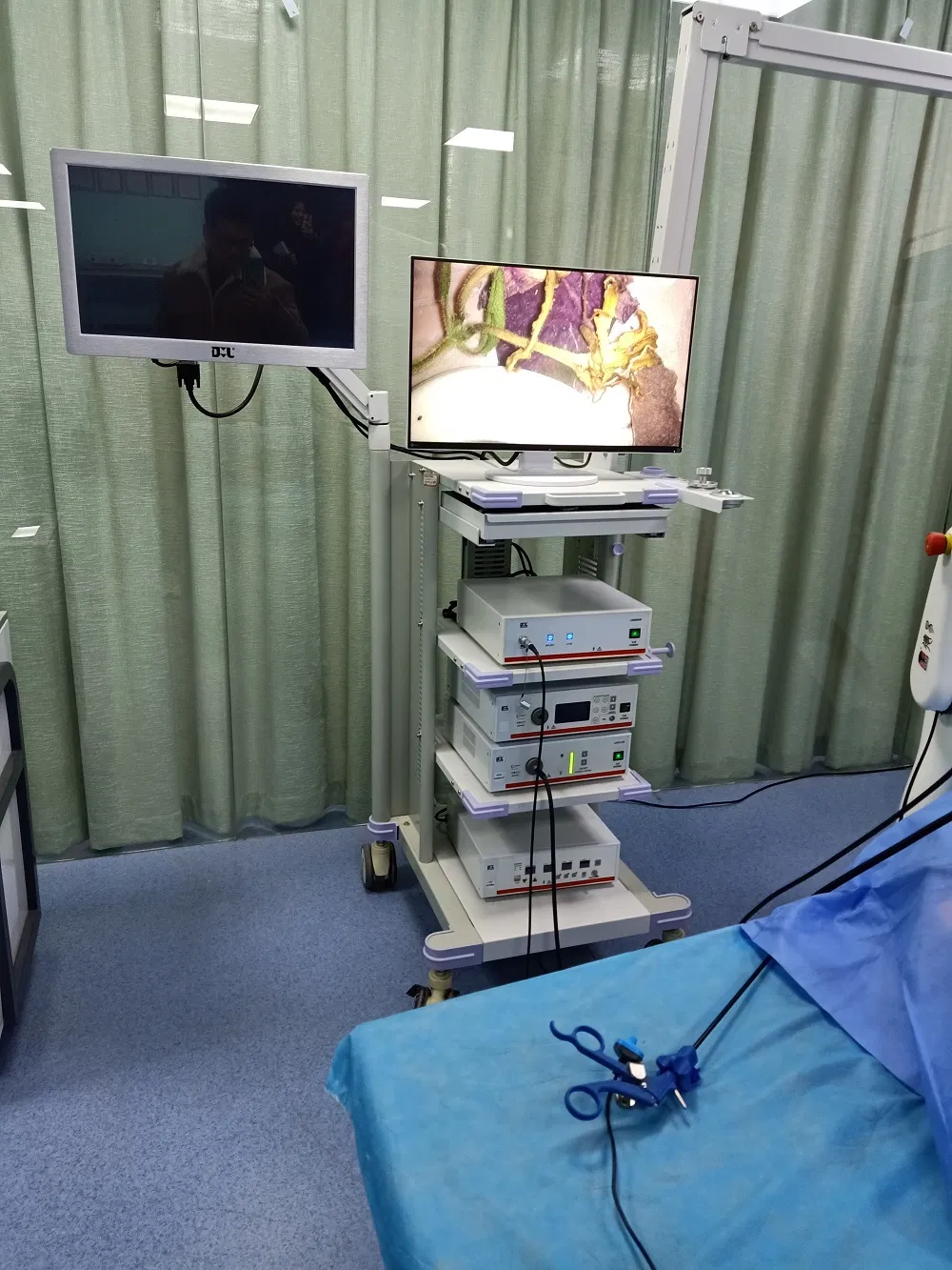 Arthroscopy System with Full HD Endoscopy Camera
