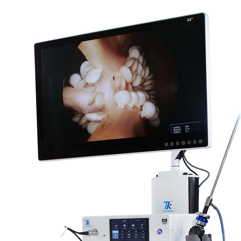 Hot Sale Flexible Endoscopy System Video Gastroscope Ent Camera System with Light Source