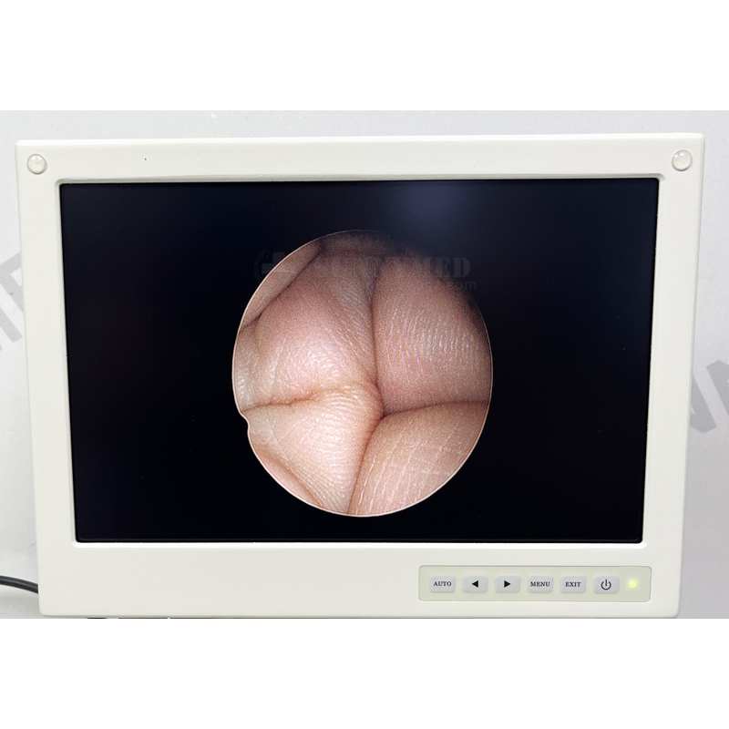 Sy-P033-2 Veterinary All-in-One Endoscope Processor Rigid &amp; Flexible Endoscopy Camera System