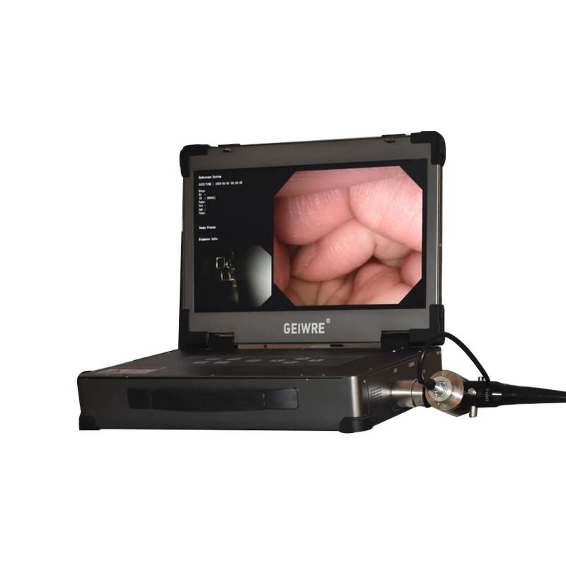 Hot Sell Endoscope Equipment for Gastoscope and Colonoscope