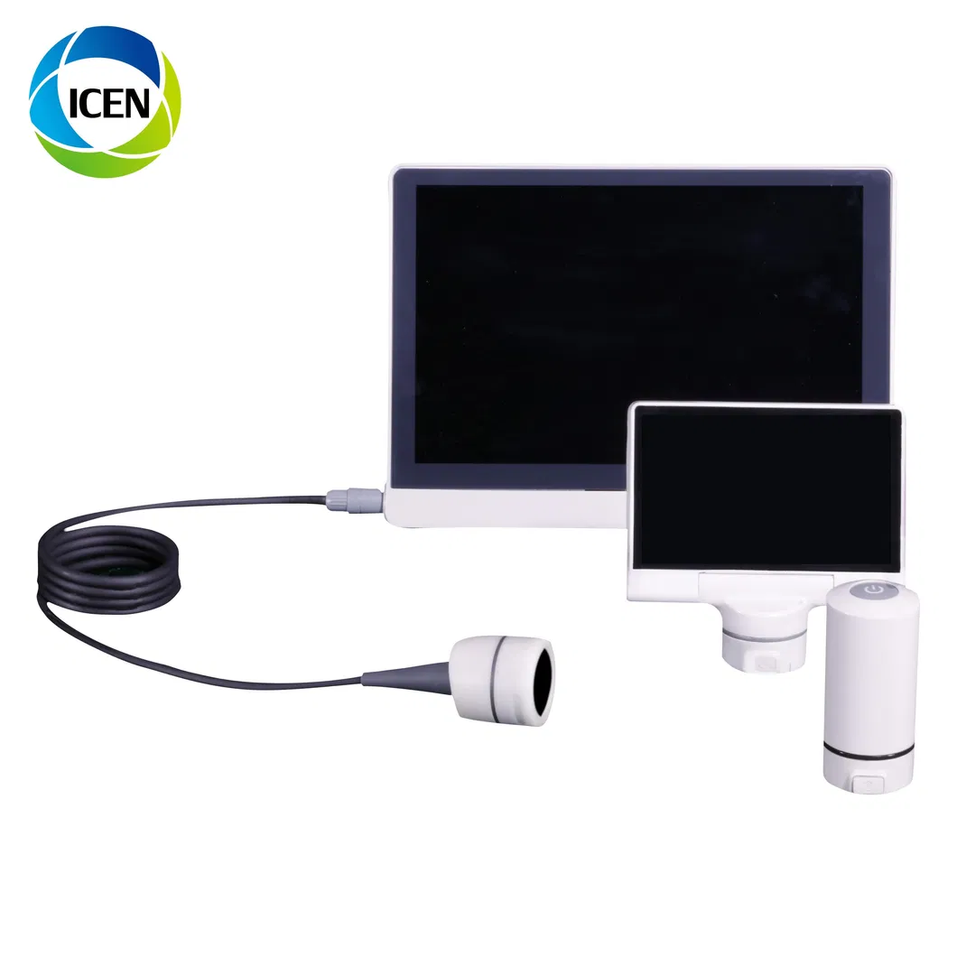 Wireless Endoscope View 2