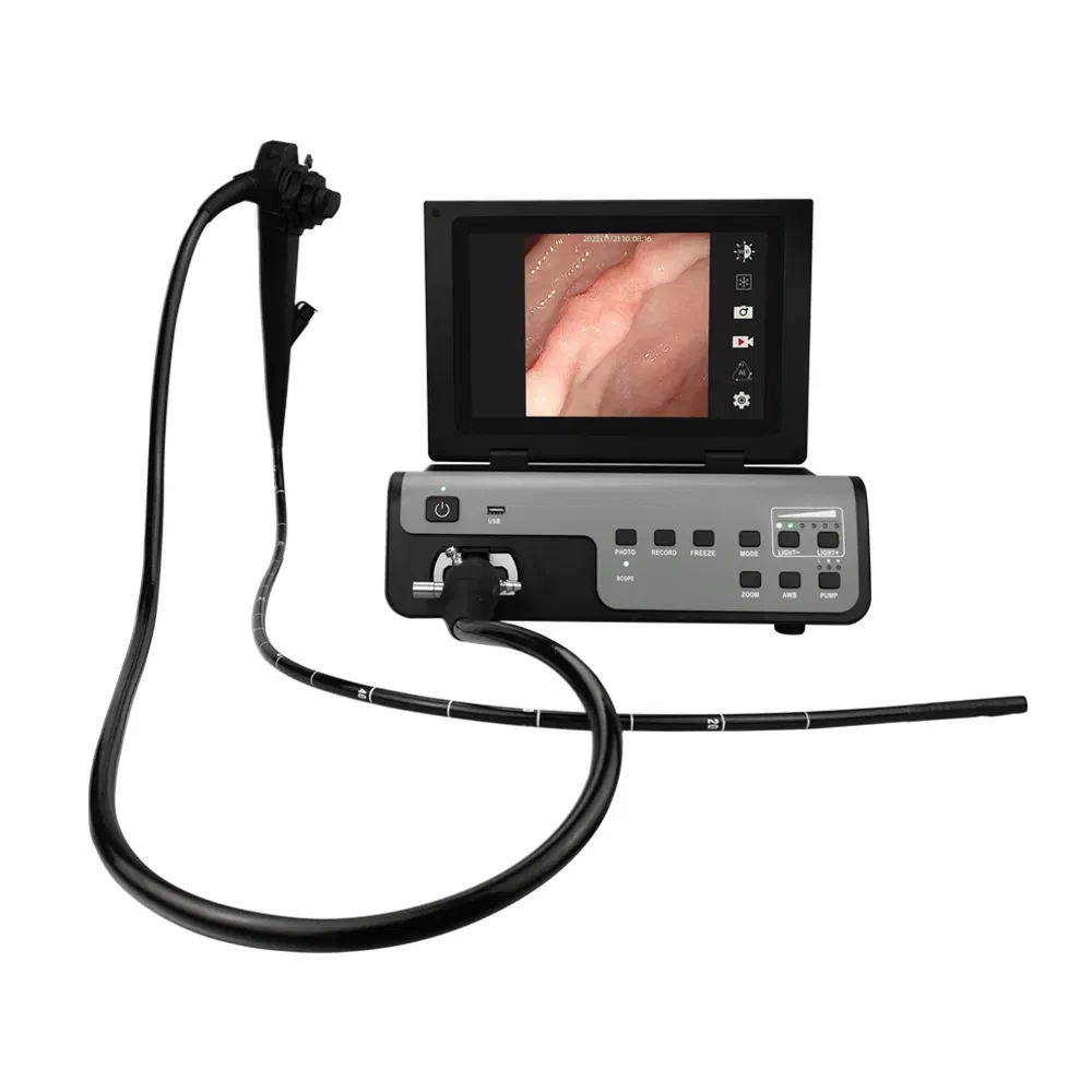 Endoscopy System 9
